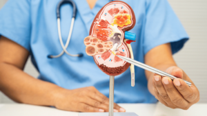 Kidney Cancer