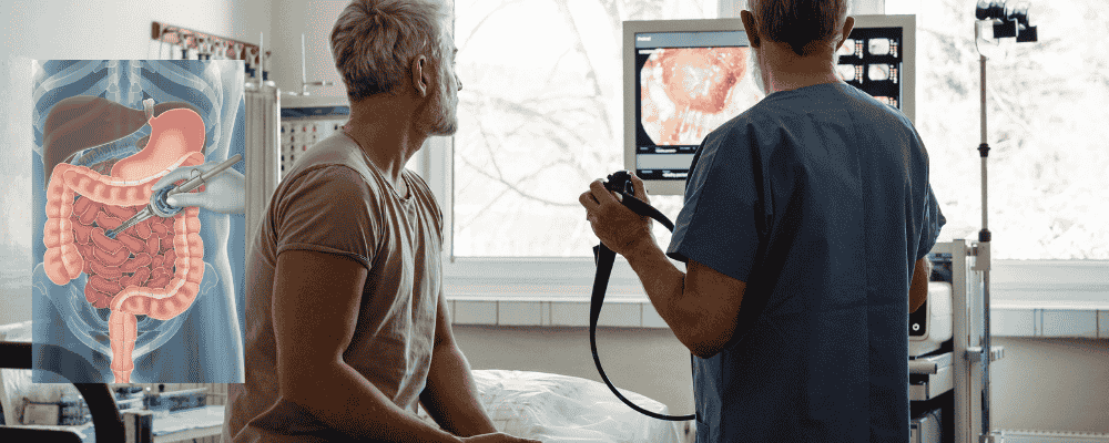 Colonoscopy