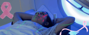 breast cancer radiation therapy