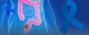 coloncancer