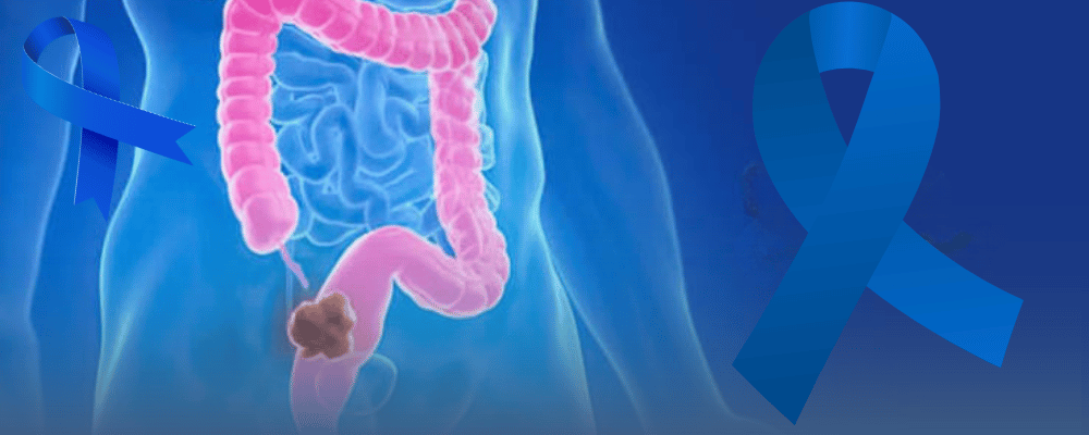 coloncancer